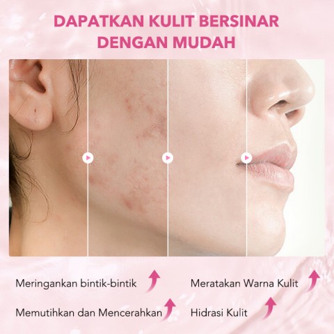 ELLEN ELLA Rose Niacinamide pemutih Trio