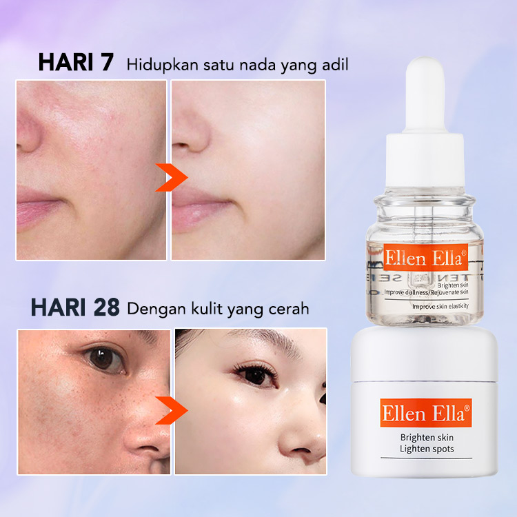 Kombo Korektor Bintik Gelap Terbaik- Mencerahkan warna kulit dan Memudar Melasma, Bintik-bintik, Bintik Matahari Bekas Jerawat dalam 7 hari