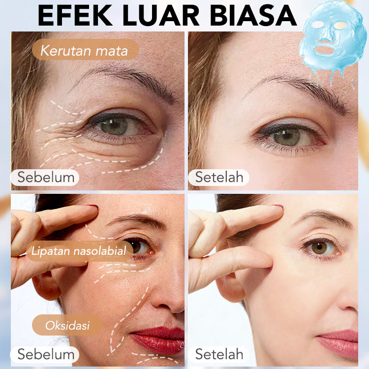 ELLEN ELLA Triple Retinol Niacinamide Anti Aging Whitening Masker Wajah - Meringankan kerutan, memecah melanin - Tiba dalam 1-4 hari - Beli 25 pcs dapat gratis 25 pcs